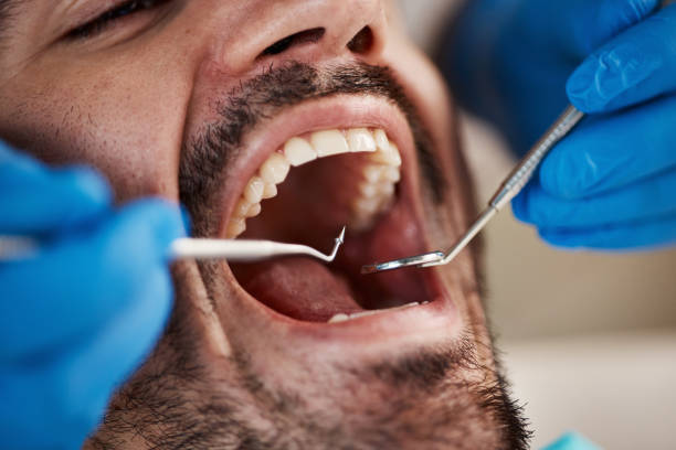 Best Weekend Emergency Dentist in Buffalo, SC