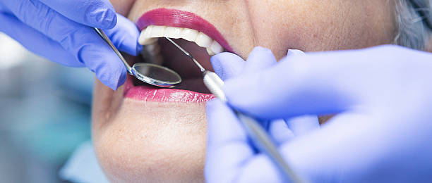 Best Emergency Tooth Extraction in Buffalo, SC